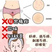 孕期下面痒（孕期下面痒怎么办）