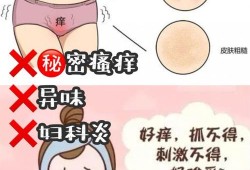 孕期下面痒（孕期下面痒怎么办）