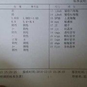 孕妇尿蛋白3+是怎么回事,妊娠蛋白尿对胎儿影响大吗