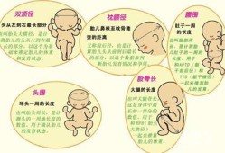 胎儿头径图（胎儿头径图片）