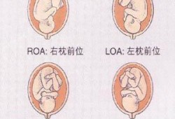 胎儿颈部未见压迹（胎儿颈部见V型压迹是什么意思）