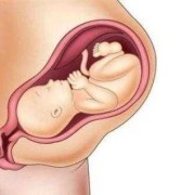 18三体胎儿孕妇表现（18三体综合症高风险怎么办）