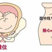 宝宝一岁一个月，走路高低肩严重,宫高低一定是胎儿小吗