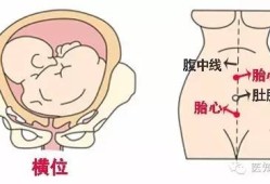 宝宝一岁一个月，走路高低肩严重,宫高低一定是胎儿小吗
