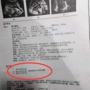 儿童没上户口如何查看核酸结果,检查胎儿是否畸形做什么检查