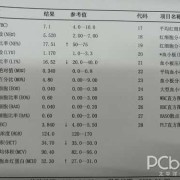 孕期血常规（孕期血常规主要看哪几项指标）
