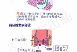 孕期长痔疮（孕期长痔疮怎么办 有肉球）