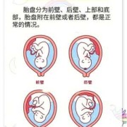 胎盘低对胎儿有影响吗（胎盘低对胎儿有影响吗孕六个月了）