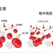 孕期地中海贫血的症状（孕期地中海贫血的症状表现）