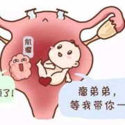 孕期子宫肌瘤注意（怀孕有子宫肌瘤有影响吗）