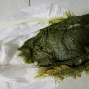 3个月的宝宝大便绿色黏黏的果冻状是怎么回事,3个月的胎儿图片真实