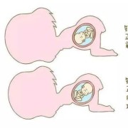 胎儿转位（胎儿转位有什么感觉）