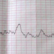 怀孕三个月胎儿有多大图片（胎心率167正常吗？怀孕三个月，胎心一般是多少）