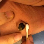 宝宝脐带有点红，搓肚子时发现出血了，怎么办?急急急,胎儿玩脐带妈妈会痛吗