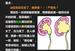 孕期输尿管结石（孕期输尿管结石怎么办）