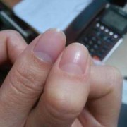 胎宝宝几周开始长指甲,胎儿指甲长会划破羊膜吗