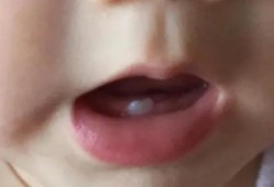 四个月宝宝长牙有什么症状,四个月胎儿样子图片