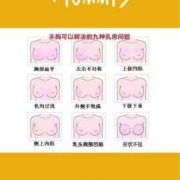 孕期乳房外扩（胸型外扩怎么办）