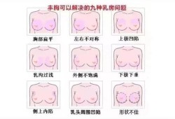 孕期乳房外扩（胸型外扩怎么办）