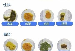 孕期排便臭（为什么每次大便都很臭？原因是什么啊）