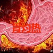 孕期胃灼热（【胃部烧灼感是什么原因】）