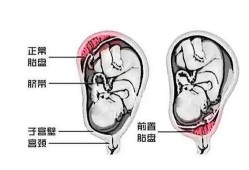 胎儿前壁和后壁的区别（胎儿前壁和后壁的区别和男孩女孩有关系吗）