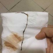整个孕期断断续续出血（整个孕期断断续续出血带血丝）