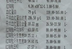 孕妇抽血结果怎么知道自己是缺什么贫血,孕期血常规怎么看贫血不贫血