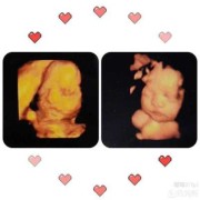 孕28周应该检查什么,28周胎儿做四维彩超要憋尿吗