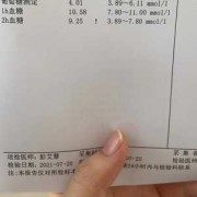糖耐没过，复查还要吃糖吗？怎么复查,孕期糖耐没过怎么办啊