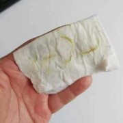 孕期流黄色分泌物（孕期流黄色分泌物怎么回事）
