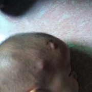 刚出生的小宝宝头部比较长，能不能恢复,胎儿头长得快怎么回事