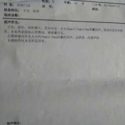 胎囊与胎儿（孕囊回声是什么意思）