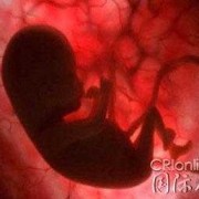 孕晚期胎儿肚子里图片（孕晚期胎儿肚子里的图）