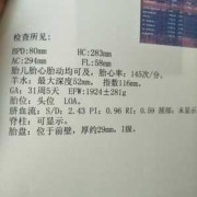 efw计算公式,efw是胎儿的什么意思