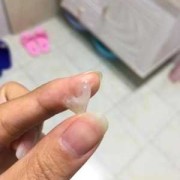 孕期取白带