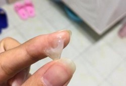 孕期取白带