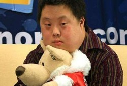 唐氏胎儿有什么表现,唐氏儿胎儿有什么症状表现
