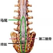 胎儿脊髓圆锥（胎儿脊髓圆锥正常位置）