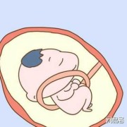 胎儿颈后见u型压迹是什么意思,胎儿u型压迹是什么意思