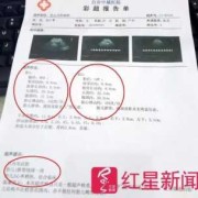 胎儿法四误诊率高吗（b超显示没有胎心会误诊吗）