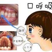 宝宝张嘴呼吸正常吗,胎儿在腹中张口正常吗会胎停吗