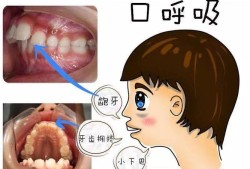 宝宝张嘴呼吸正常吗,胎儿在腹中张口正常吗会胎停吗