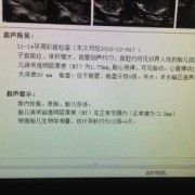 超声胎儿诊断（超声胎儿诊断怎么写）