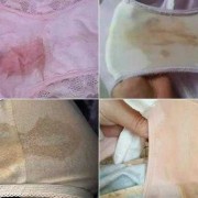 孕期下面总是湿的（孕期下面总是湿的正常吗）