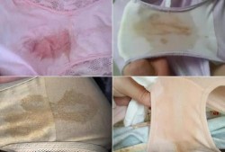 孕期下面总是湿的（孕期下面总是湿的正常吗）