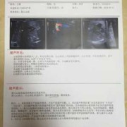 胎儿右心室强回声（胎儿右心室强回声是什么意思）