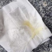 孕期白带好多