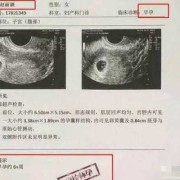 为什么怀孕实际天数跟B超不一样,孕期b超数据对照表