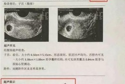 为什么怀孕实际天数跟B超不一样,孕期b超数据对照表